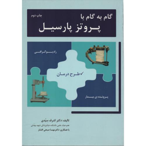 گام به گام با پروتز پارسیل (رویان پژوه)