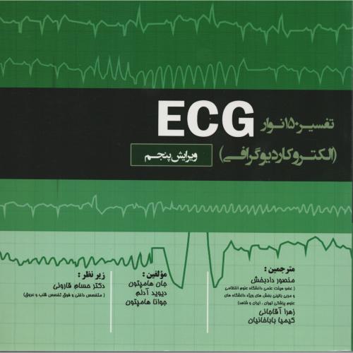 تفسیر 150 نوار الکتروکاردیوگرافی ECG (تیمورزاده نوین)